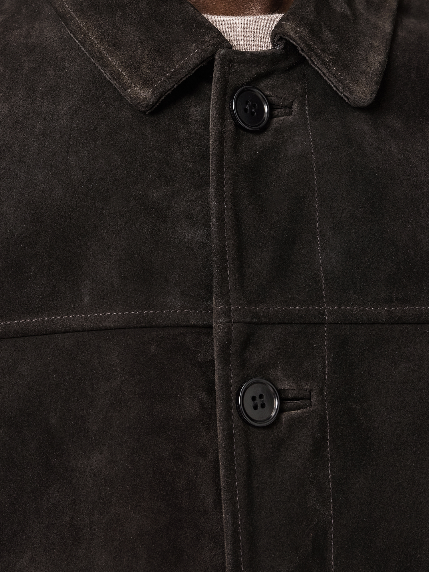 BUTTON CLOSURE