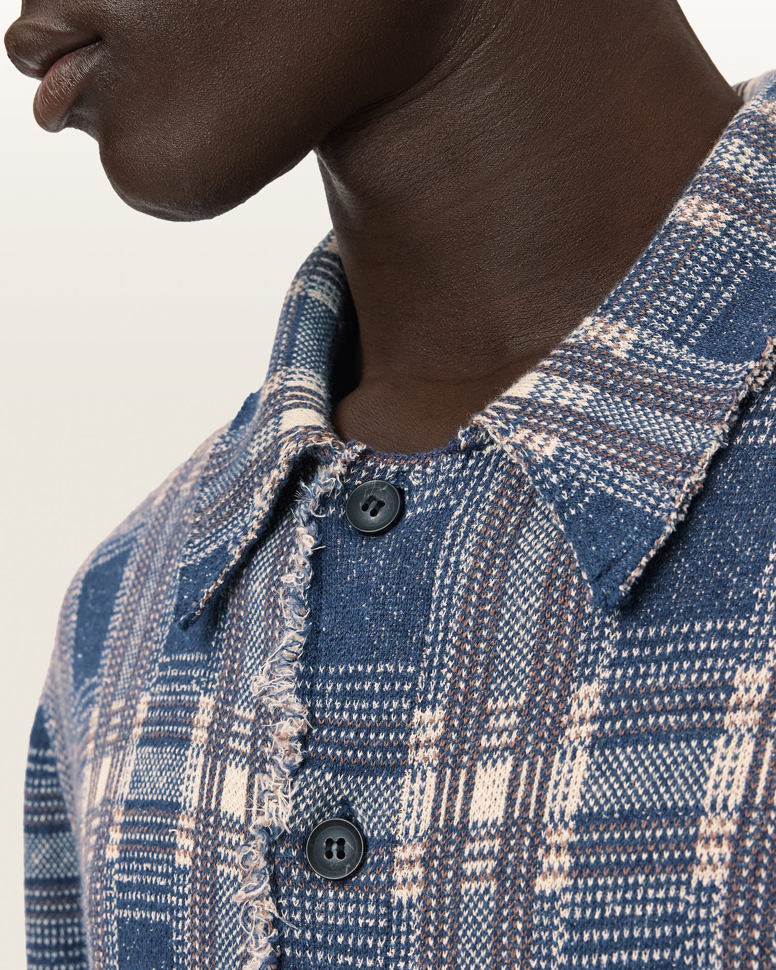 BUTTON CLOSURE